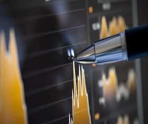 ETFs: Low cost, simple investments